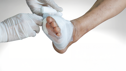 Diabetes foot management and care