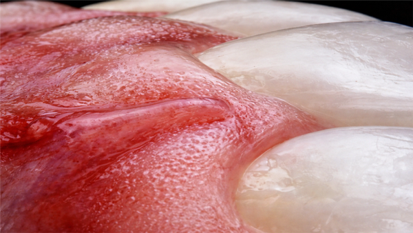 Is Your Diet Soda Hurting Your Teeth? The Truth About Enamel Erosion